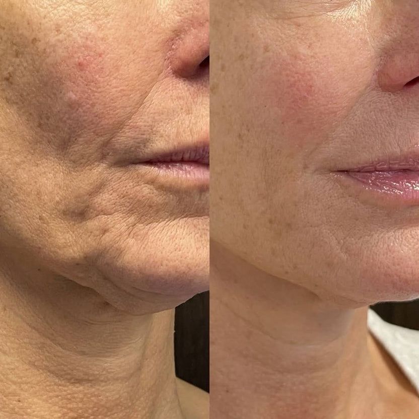 11533cbe0a1fc46f6742c9224b8732b7