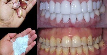 613582314 122100605727202893 413821963930319859 n