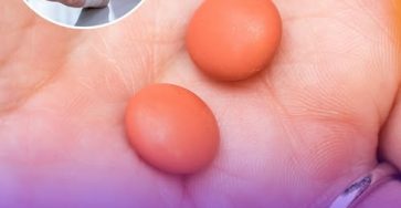 643824303 122292209636178654 5295499920760645197 n