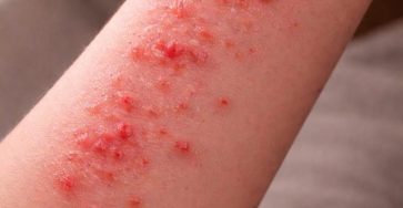 648836742 122232229310271956 8802968970652089123 n