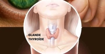 Debff41a 29e6 4a61 b172 c6a2386fa519