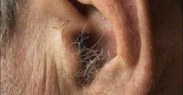 Le saviez vous si des poils commencent a pousser dans vos oreilles.jpg