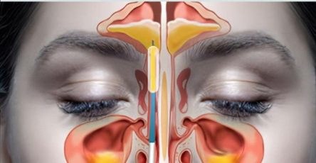 560038214 122132578964943773 3720309390641553775 n