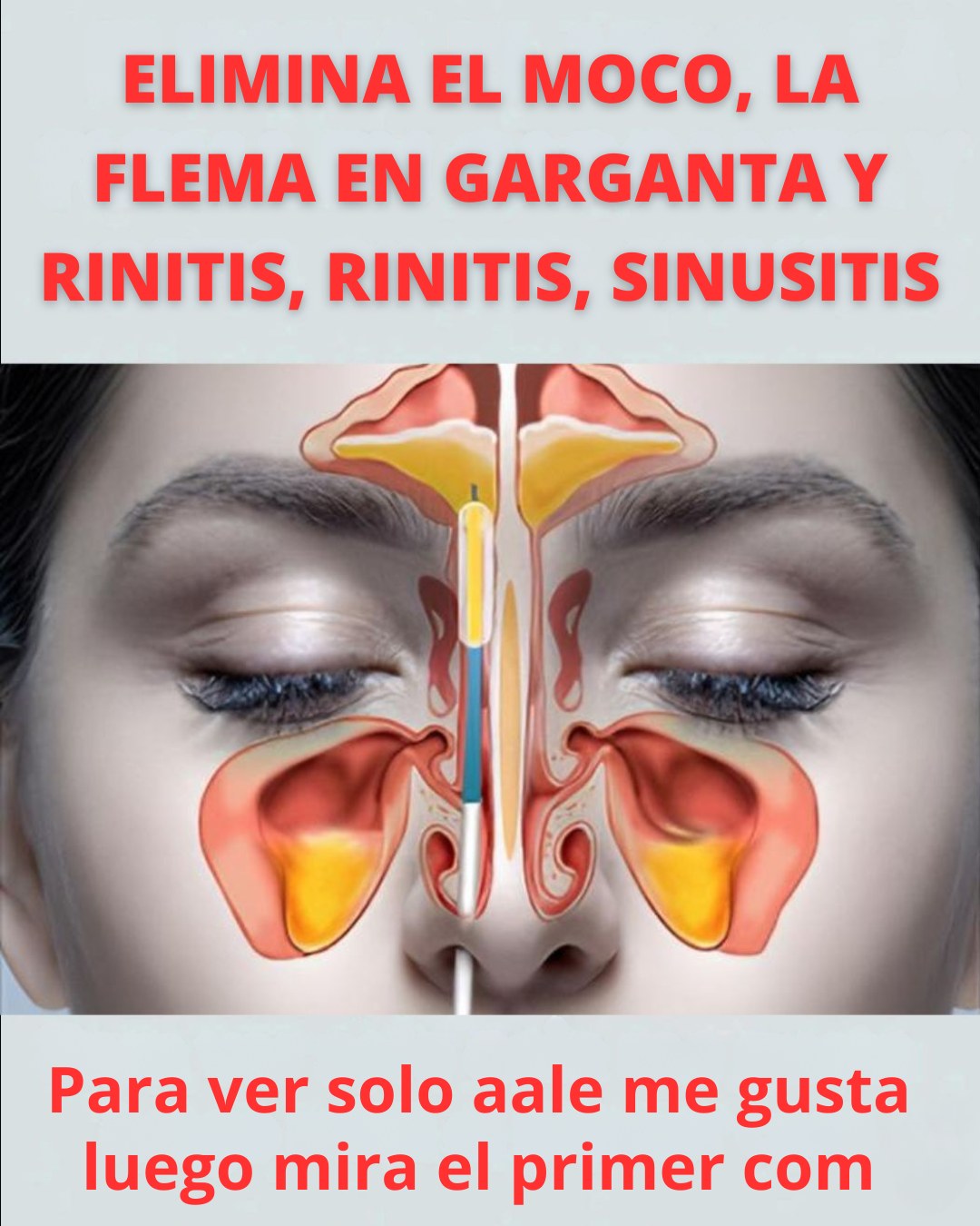 560038214 122132578964943773 3720309390641553775 n