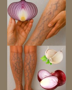 565154031 122133762794943773 474055811383662447 n