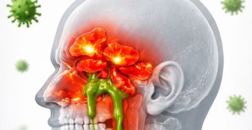 649837469 122159314850943773 6535116923549015866 n